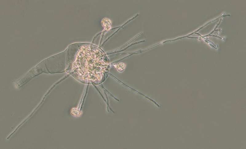Like other animals, bdelloid rotifers need strategies to fight off infections and avoid ending up like this diseased individual, which has been taken over and killed by a fungus. Credit: C. G. Wilson 2024 Small animals acquire genes from bacteria that can produce antibiotics